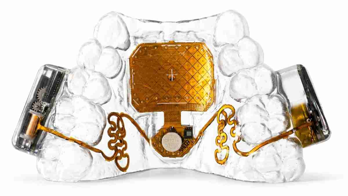 Dental surgical implant device with a gold circuit panel embedded in a transparent jaw model.